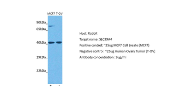 SLC39A4 Rabbit Polyclonal Antibody