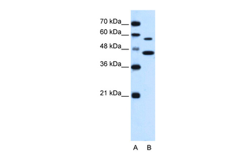 SLC39A5 Rabbit Polyclonal Antibody