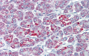 SLC39A5 Rabbit Polyclonal Antibody