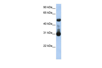 ACVRL1 Rabbit Polyclonal Antibody