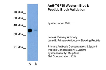 TGFBI Rabbit Polyclonal Antibody