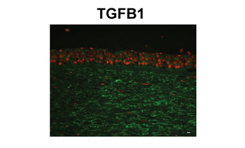 TGFBI Rabbit Polyclonal Antibody