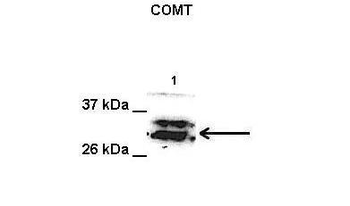 COMT Rabbit Polyclonal Antibody