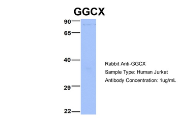 GGCX Rabbit Polyclonal Antibody