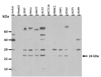 PDPN Rabbit Polyclonal Antibody