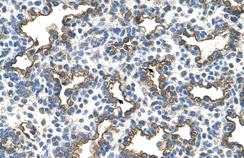 PDPN Rabbit Polyclonal Antibody