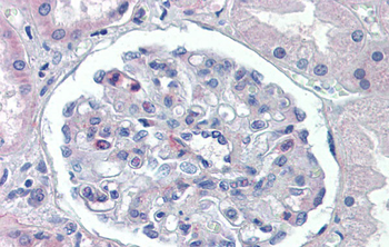 PODXL Rabbit Polyclonal Antibody