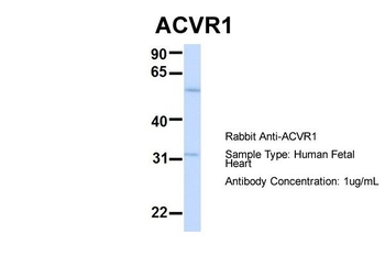 ACVR1 Rabbit Polyclonal Antibody