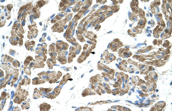 ACVR1 Rabbit Polyclonal Antibody