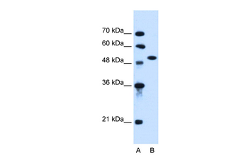 ACVR1 Rabbit Polyclonal Antibody