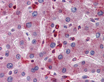 ACP2 Rabbit Polyclonal Antibody