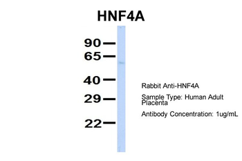HNF4A Rabbit Polyclonal Antibody