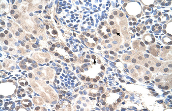 RORA Rabbit Polyclonal Antibody