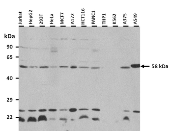 RORC Rabbit Polyclonal Antibody