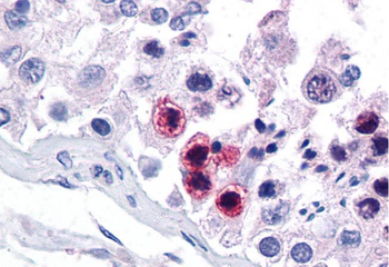 RORC Rabbit Polyclonal Antibody