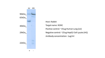 RORC Rabbit Polyclonal Antibody