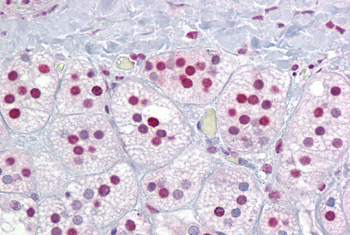 RORA Rabbit Polyclonal Antibody