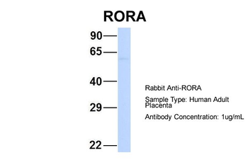 RORA Rabbit Polyclonal Antibody