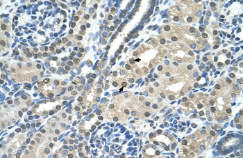 SBDS Rabbit Polyclonal Antibody