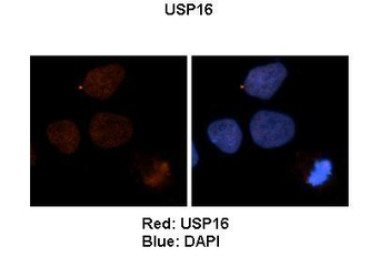 USP16 Rabbit Polyclonal Antibody