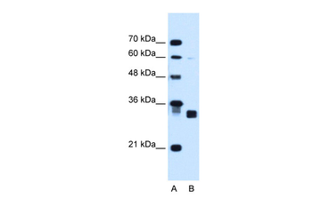 CBR1 Rabbit Polyclonal Antibody