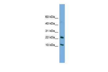 GM2A Rabbit Polyclonal Antibody