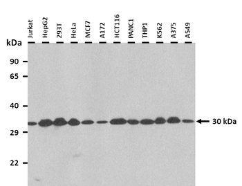 PSME3 Rabbit Polyclonal Antibody