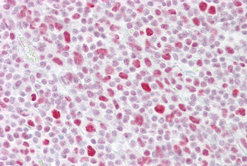 PSME3 Rabbit Polyclonal Antibody