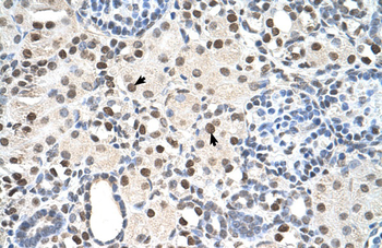 PSME3 Rabbit Polyclonal Antibody