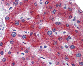 MTHFD1 Rabbit Polyclonal Antibody