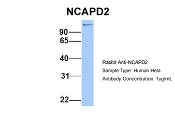 NCAPD2 Rabbit Polyclonal Antibody