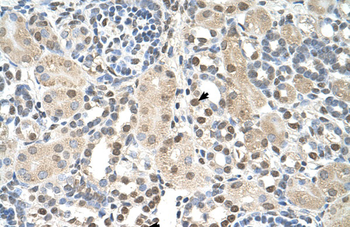 PSAT1 Rabbit Polyclonal Antibody