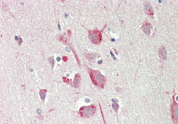 PSAT1 Rabbit Polyclonal Antibody