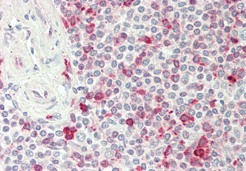 PSAT1 Rabbit Polyclonal Antibody