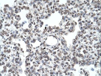 TMPRSS11D Rabbit Polyclonal Antibody