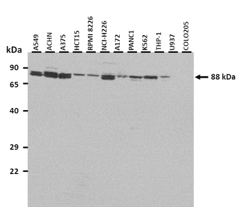 CPT1B Rabbit Polyclonal Antibody