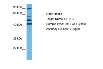 CPT1B Rabbit Polyclonal Antibody