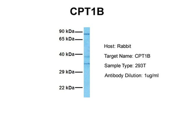 CPT1B Rabbit Polyclonal Antibody