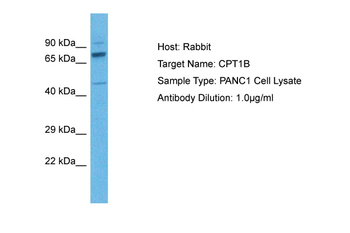 CPT1B Rabbit Polyclonal Antibody