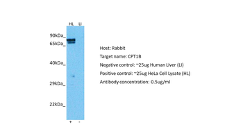 CPT1B Rabbit Polyclonal Antibody