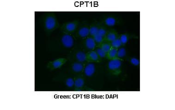 CPT1B Rabbit Polyclonal Antibody