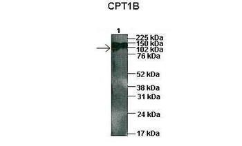 CPT1B Rabbit Polyclonal Antibody