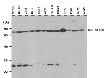 DLL1 Rabbit Polyclonal Antibody