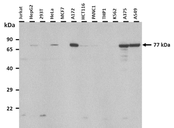 TGM2 Rabbit Polyclonal Antibody