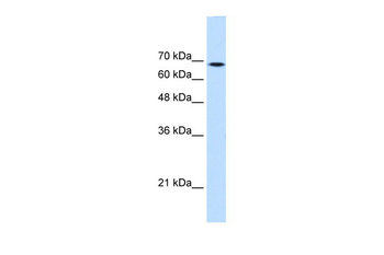 TGM2 Rabbit Polyclonal Antibody