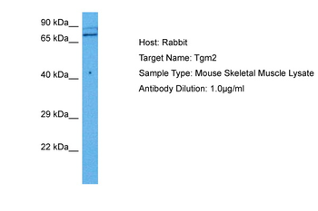 TGM2 Rabbit Polyclonal Antibody