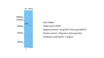 SETD2 Rabbit Polyclonal Antibody