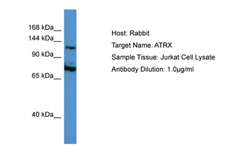 ATRX Rabbit Polyclonal Antibody