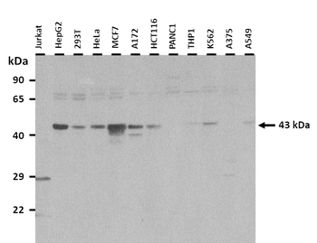 NDRG1 Rabbit Polyclonal Antibody
