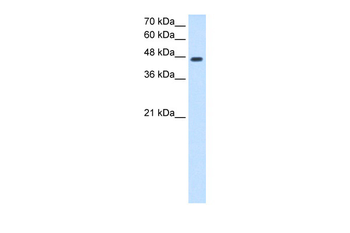 NDRG1 Rabbit Polyclonal Antibody